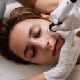 Facial skin hydropeeling. High quality photo